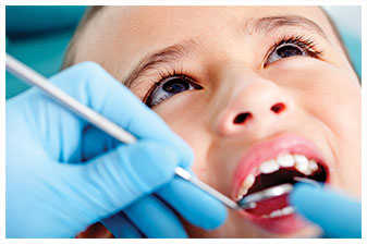Dental Sealants Dentist Colmar PA
