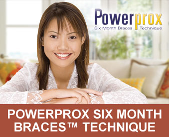 PowerProx Short Term Dental Braces Colmar PA