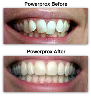 PowerProx Dentist Colmar PA